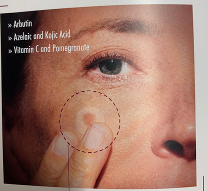 RITUALE SKINGLOW ANTI MACCHIE - COFANETTO CREMA + SIERO + PATCH